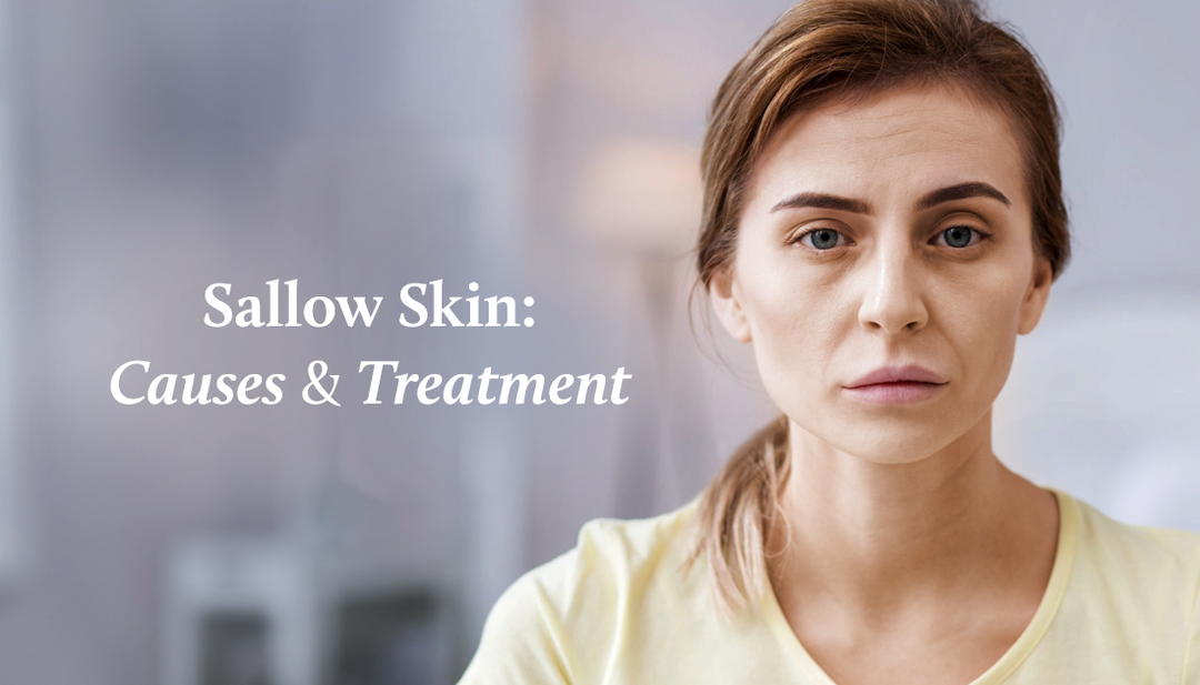 Sallow Skin Causes & Treatment